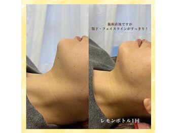 ナスサロ/レモンボトル