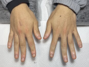ミコ(.mico)の写真/丁寧な施術で高評価！駅近で無料駐車場もあるので通いやすく、貸切空間でリラックスして施術が受けられる。