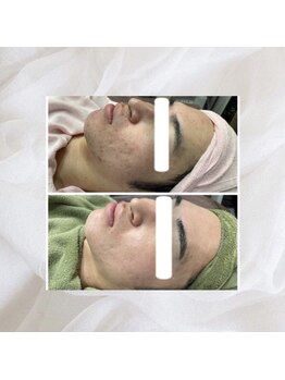 プリマプリート 名駅店/VOSサロンケア