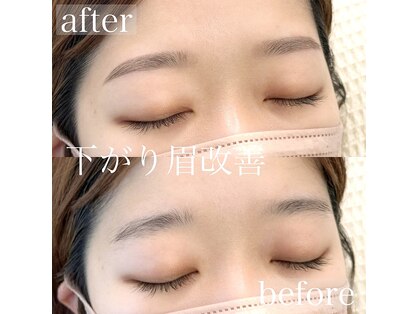 ミリミリ バイ エス(MiliMili by S)の写真