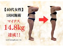 イタ 岡崎店(ita)の雰囲気(【マイナス14.8kg】確実に結果が出る当店人気No.1の"インド痩身")