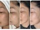 レアリスの写真/シミ・くすみ・色ムラを本気で改善したい方へ。隠すメイクから、すっぴんに自信が持てる毎日へ。