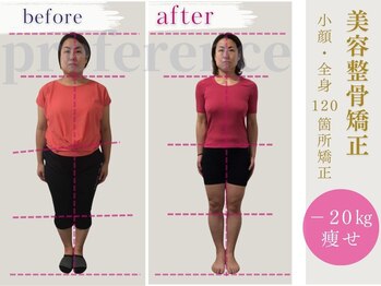 プレフェランス(Preference)/肩こり/腰痛/整体/痩身/美脚