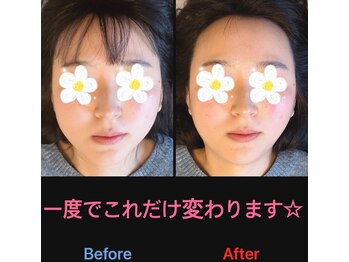 美容矯正サロン レレポノ(LELEPONO)/一度で変わります