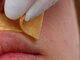 ミモア(mimoi.)の写真/フェイシャルwaxで産毛や角質をスッキリOFF！ワントーン明るいお肌へ☆スキンケアの浸透も格段にUP♪