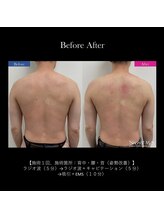 リュウヴィ(Ryuvi)/