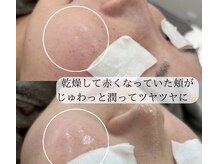 ミュー 徳川店(mieux)/