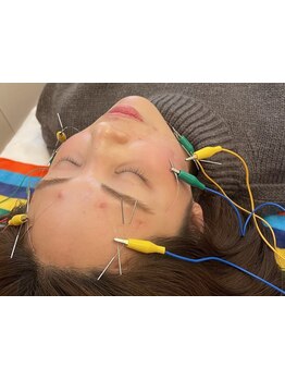 小顔になりたい