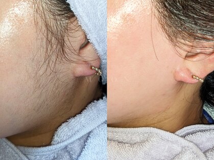 ムーン 横浜(MOON)の写真