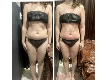 アクワレル ゆりまち袖ケ浦駅前モール店(aquarelle)/スリムムーブ×2回コース