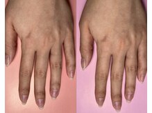 ユルックネイル(yluck nail)の雰囲気（お肌にあったカラーを見つけるためにお時間しっかり確保◎）