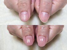 グラシナ なんば店/深爪/自爪育成/フィルイン