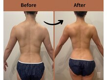 テン エイト(10 8)/上半身撃退