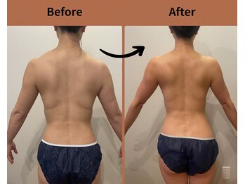 テン エイト(10 8)/上半身撃退