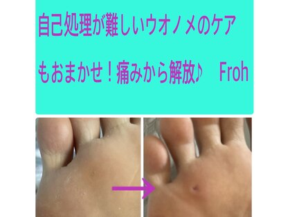 フロー(Froh)の写真