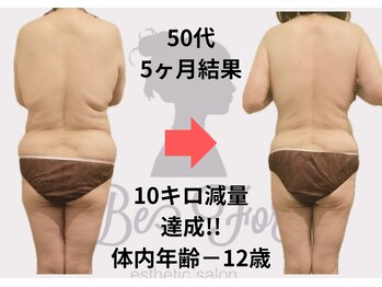 ビーフォー(be for)/10kg減量成功♪