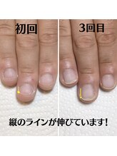 スマイルニコ(smile nico)/