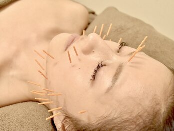 ドリームスタイル 川崎駅前(Dream Style)/顔のリフトアップ＋ハリツヤ美肌