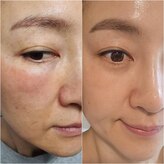 アルバビューティーサロン(Alva beauty salon)