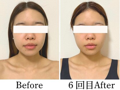 ビコツプロ(Bikotsu Pro)の写真