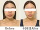 ビコツプロ(Bikotsu Pro)の写真