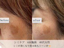モラン(MO.RAN)/手軽にシミ改善♪