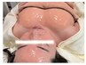 炭酸パック&ヒト幹細胞上清液60%高濃度美容液【手背・くるぶしのくすみ】