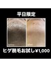 【平日男性限定】結果重視にこだわるお得なヒゲ脱毛お試し1000円