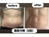 【理想のくびれ！】腰回りもスッキリ！脂肪分解（お腹）