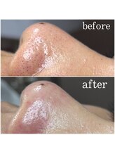 ティーツリー 名古屋 桜山(Tea Tree)/しっかり結果を出しますよ！