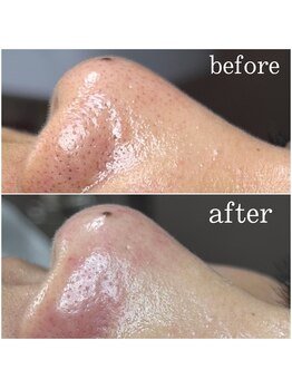 ティーツリー 名古屋 桜山(Tea Tree)/しっかり結果を出しますよ！