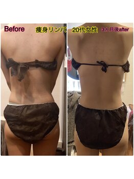 リソル(RISOL)/ダイエットお悩みの方☆