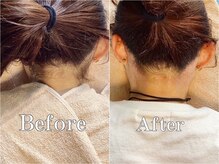 セドニー 代官山(CEDNEI)/【うなじWax脱毛】