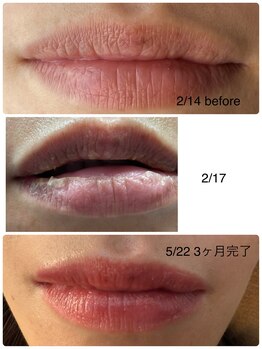 コルノ ラッシュアンドビヨンド(Corno Lash&beyond)/唇ローマピンク(30代)