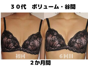 バストサロン メルベイユ(Merveile)/谷間UP、バストの立体感UP