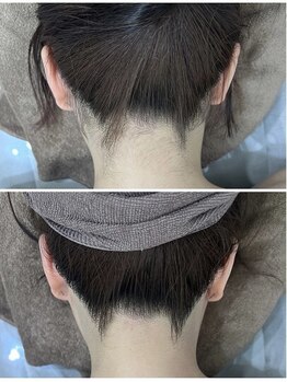 ミース 北九州店/うなじ●ビフォーアフター