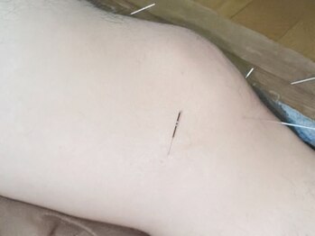 トーン(Thorn)の写真/松山市駅すぐ◎足のむくみや日々の疲れを和らげ、スッキリ軽くて動きやすい人生を楽しめる身体へ導く♪