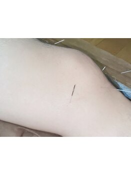 足のむくみを解消したい