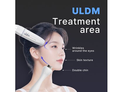 ジュエッテ(jouete)の写真