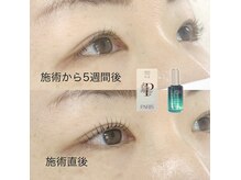 デイリー ラッシュ(DAILY LASH)/持ちはおよそ5週間
