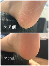 ネロリ(Neroli)/ガサガサかかとがフワフワに！