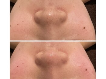 チェンジ 小山店(Change)/ビオフィート