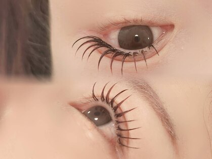 ソミ(SOMI)の写真