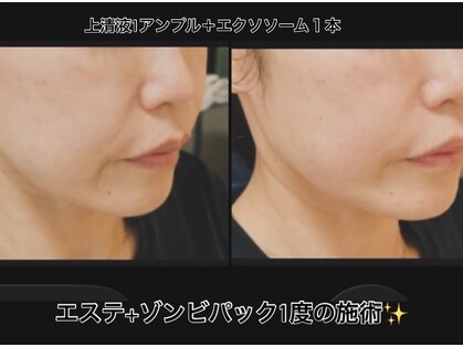 サロンモコ(Salon Moco)の写真