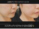 サロンモコ(Salon Moco)の写真