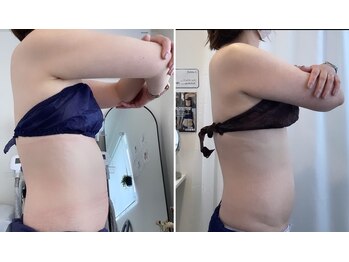 プレズィール(Plaisir)/ダイエットモニター様