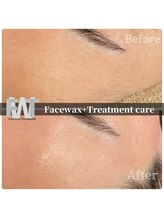 モンクラッシー(Mon classy)/肌質改善にも◎