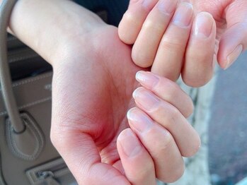 エヌプラス(Nplus)の写真/爪の形のコンプレックスはエヌプラスへご相談ください♪[ジェル不使用でケア育成]健康的な縦爪へ導きます◎