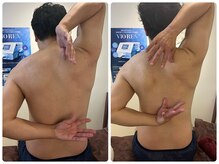 ピンクマジック(PINKMAGIC)/リリースカッター施術ビフォアフ