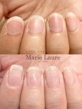 マリーロール 梅田店(Marie Laure)/深爪矯正/自爪育成/自爪風